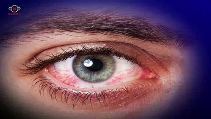 Eye problems and treatment