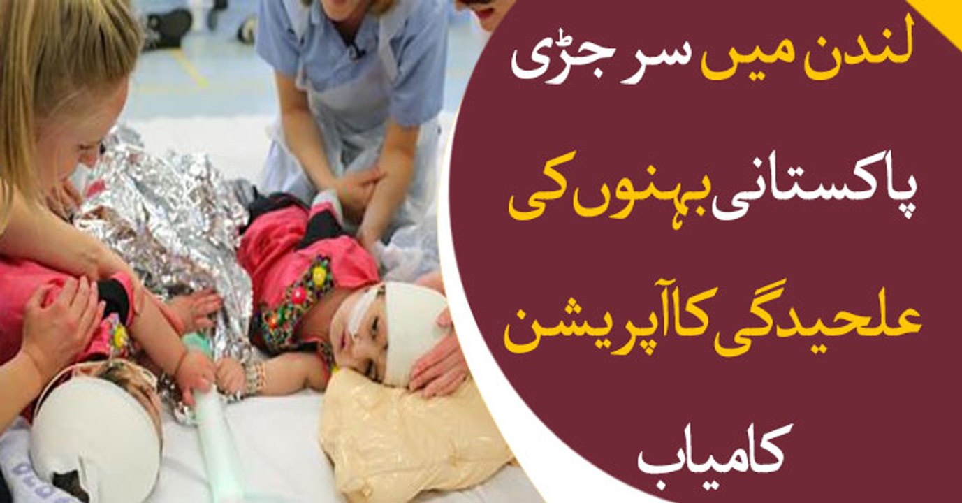 Conjoined Pakistani twins separated after 50 hours of surgery in London