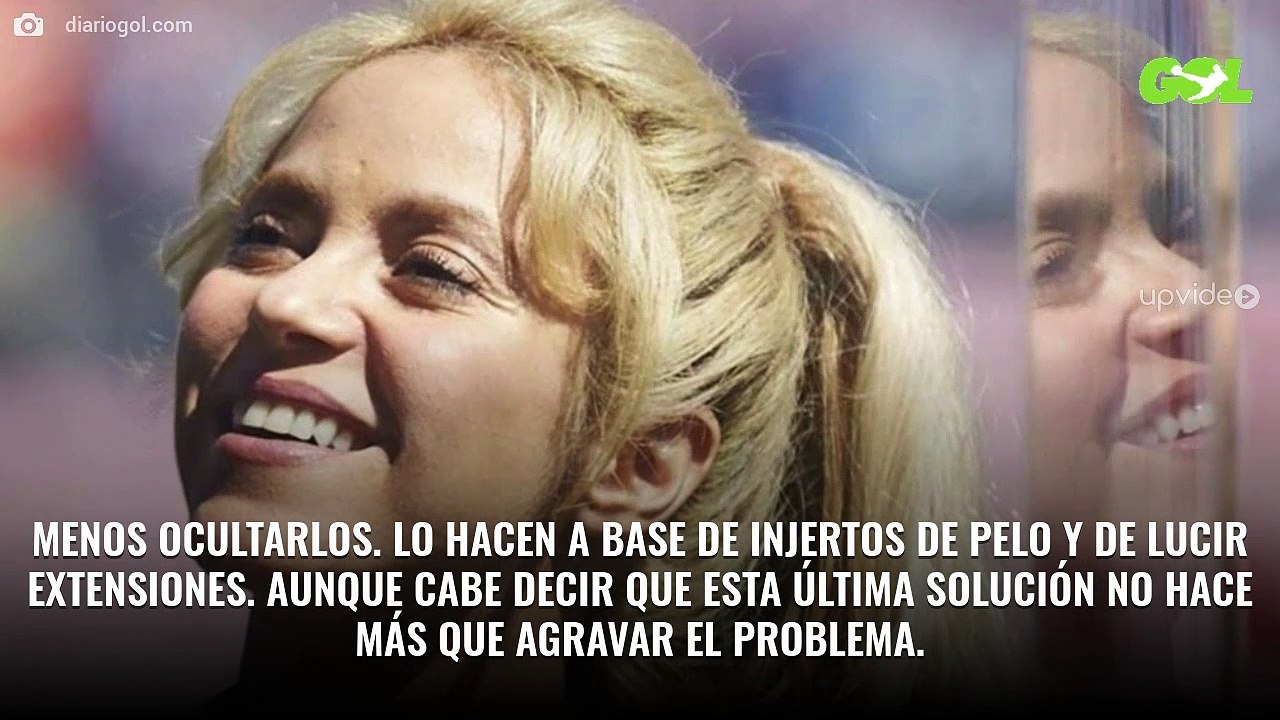 “¡Shakira está calva!”. La foto sin extensiones: “¡No me lo creo!” o “¡Pelona!”