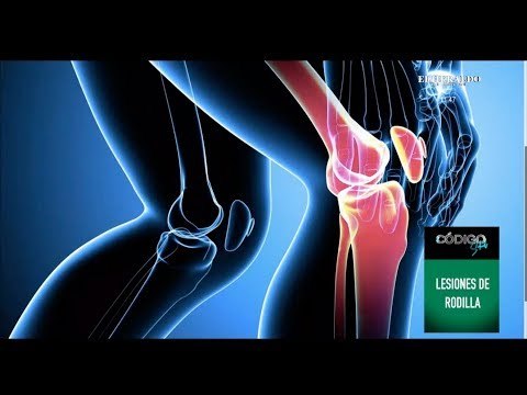 ¿Cuales son los padecimientos de rodilla más comunes?