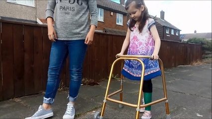 Amazing Imogen walks again after amputation