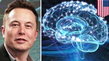 Elon Musk wants to merge humans and AI with brain implant