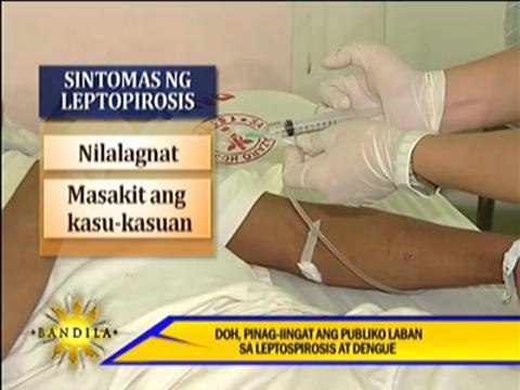 DOH warns public over rainy season diseases
