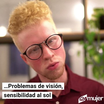 Extrañas y hermosas características humanas que en realidad son mutaciones genéticas