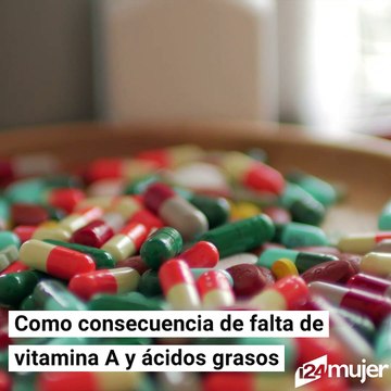 Si tienes granitos en los brazos es posible que tengas esta enfermedad