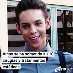 Alien man - Hombre remueve genitales para parecer un alien