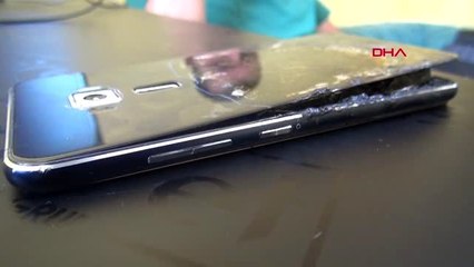 KARAMAN CEBİNDEKİ TELEFONUN BATARYASI PATLAYAN SÜRÜCÜ YARALANDI