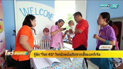 รู้จัก โรค 4S โรคผิวหนังเกิดจากเชื้อแบคทีเรีย -โชว์ข่าวเช้านี้