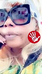 Attaquée, Eudoxie Yao fait se fait opérer et donne les raisons