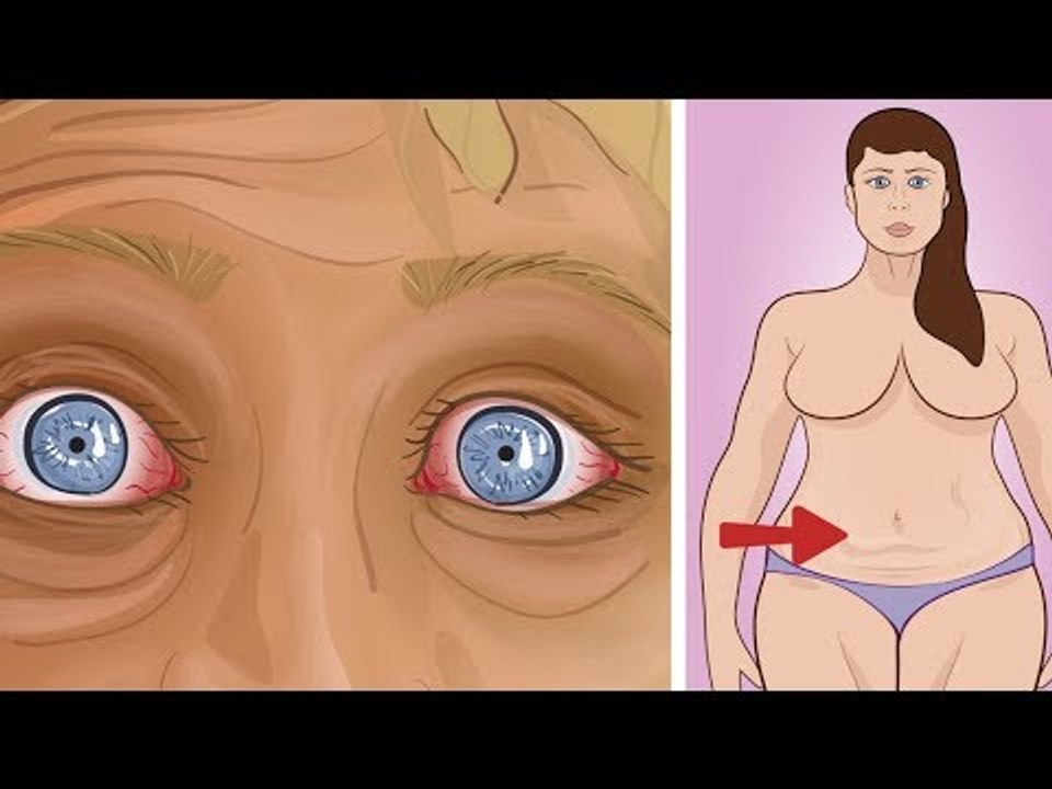 Übergewicht durch diese Angewohnheit vorm Schlafengehen.