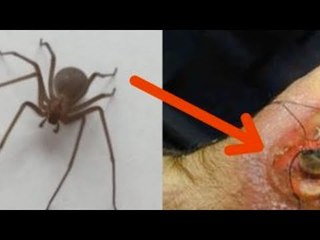 Siehst du diese Spinne, solltest du so schnell wie mög...