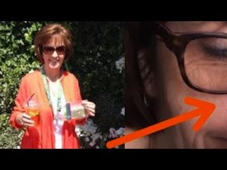 Mitten in ihr Gesicht pflanzt sich ein nie gesehenes Tier.