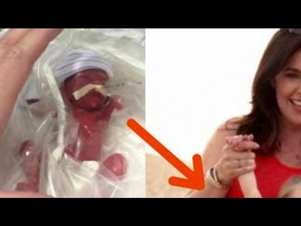 Ärzten stockt der Atem, als sie zum 1. Mal dieses Baby sehen.