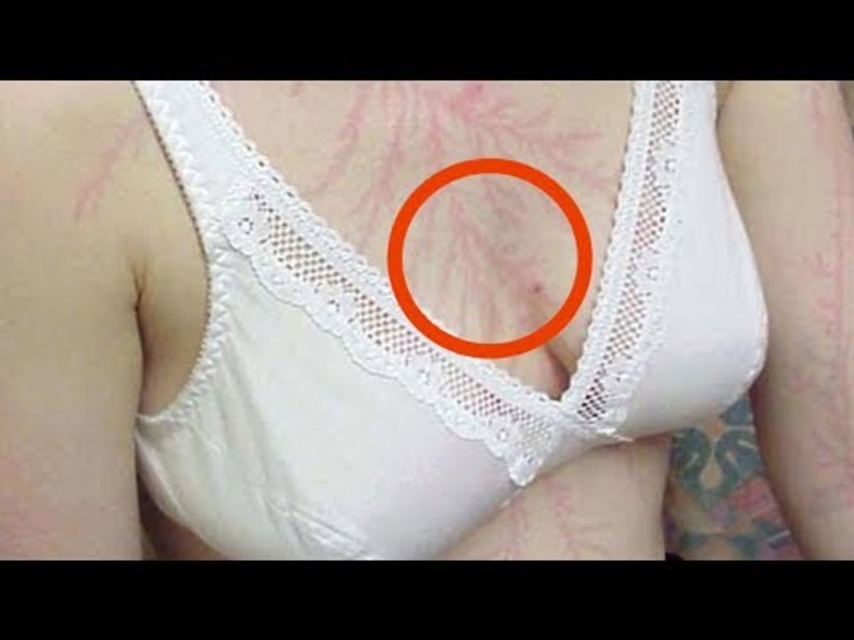 Es sieht aus wie ein Tattoo, aber es hätte sie fast getö...