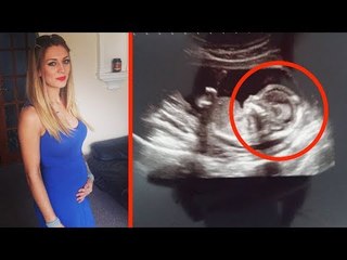 Ärzte beruhigen die Schwangere, doch ihr Hund wittert...