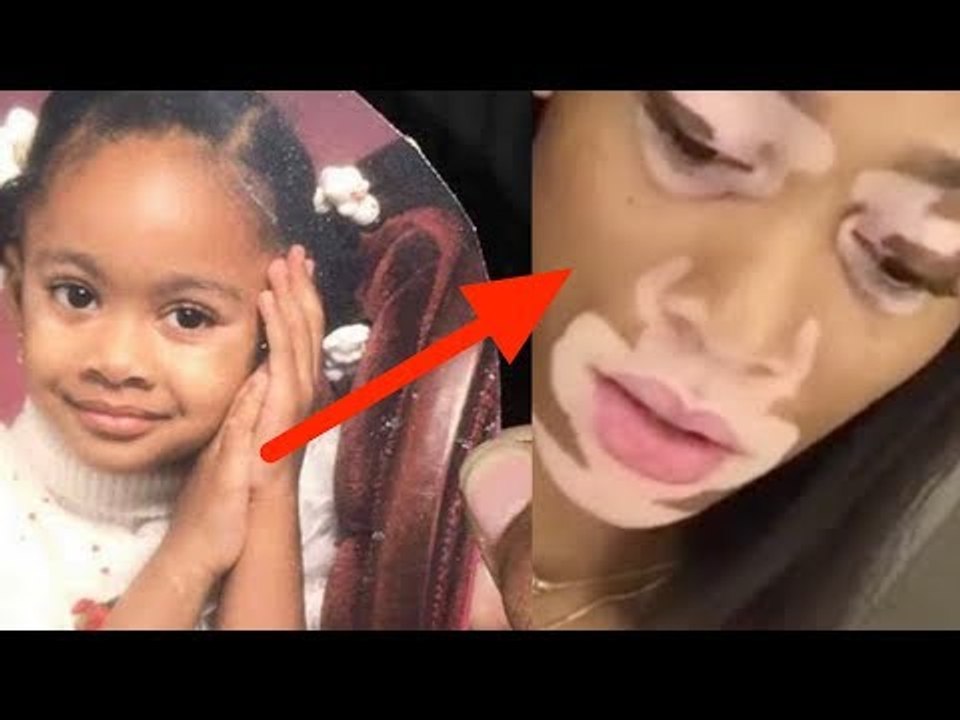 Was Ärzte bei Mädchen entdecken, macht sie 15 Jahre später zum Star.