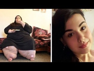 1 Jahr nach der OP geht sie zum Arzt. Ihm fallen die A...