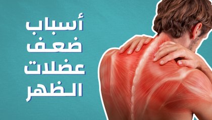 أسباب ضعف عضلات الظهر