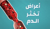 أعراض تخثر الدم