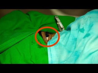 Mother Removes Bandages In Front Of Her Son & Then Come The...