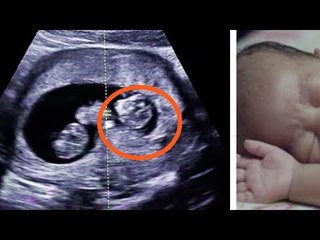 This Woman Was Cheating On Her Husband. After She Gave Birth, He Got A Hard Dose Of Reality.