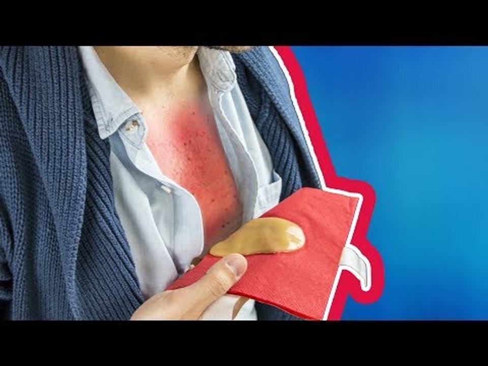 Faites un Honey Wrap et oubliez les pastilles, le sirop et les médicaments pour la toux.