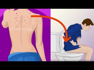 THAT'S what the pimples on your body are telling you. Amazing!