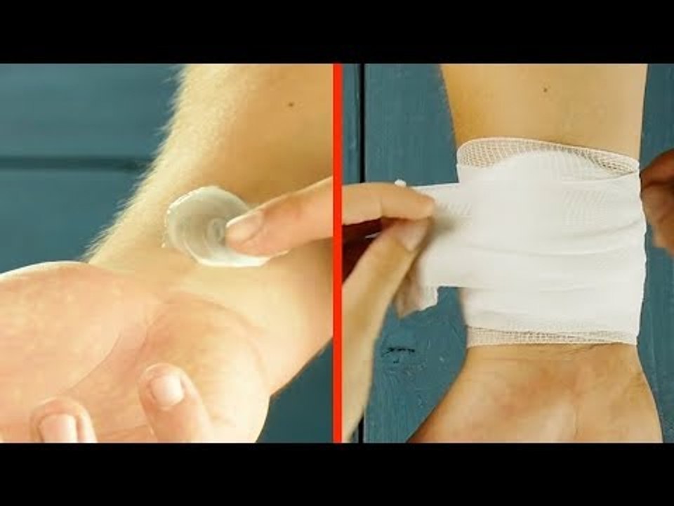 Smear Toothpaste On Your Arm. The Next Day You'll Be Speechless!