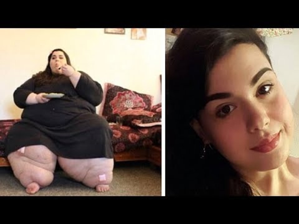 1 ano depois da cirurgia, ela vai ao médico. Ao vê-la, ele fica…