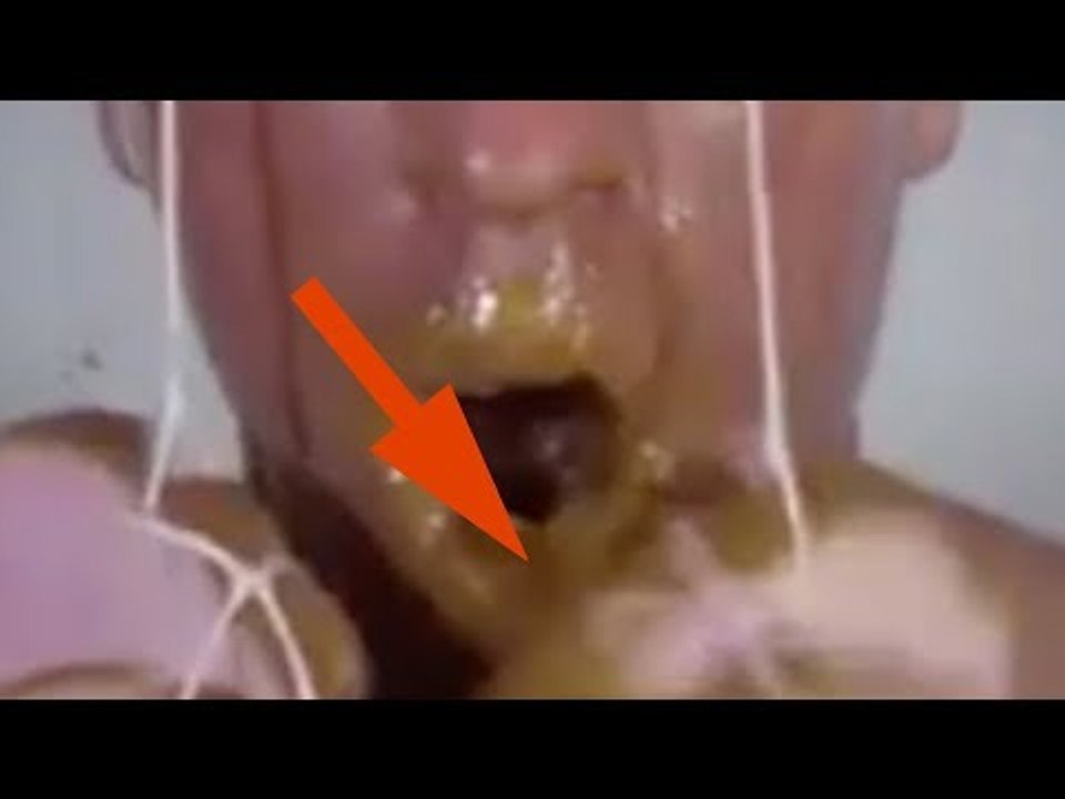 O que aconteceu com o rosto do homem chocou mui….