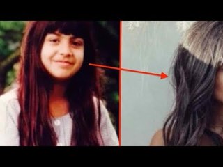 Cette jeune fille s'est faite renverser par une voiture. Voilà à quoi elle ressemble aujourd'hui.