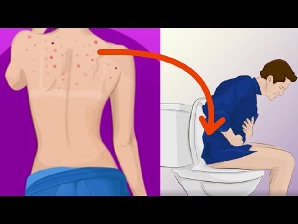 É ISTO o que você pode interpretar vendo suas espinhas. Incrível!
