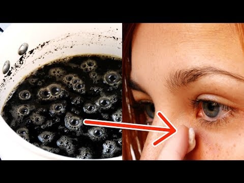 Ela coloca pó de café nos olhos. 2 min depois, o resultado é surpreendente!