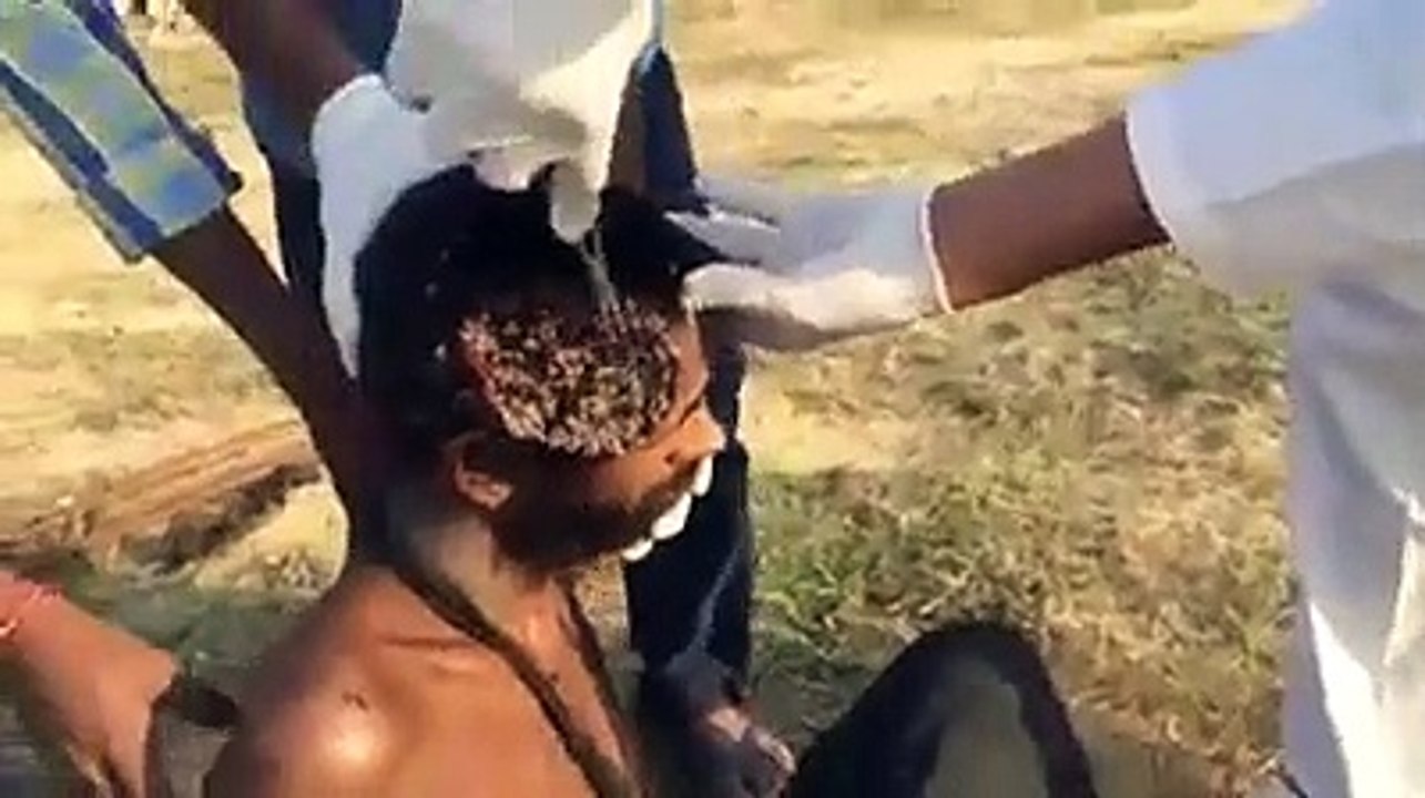 Bugs in human body kide pade sarme