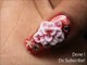 Easiest 3D Nail Art !! - learn  Acrylic Nail Designs