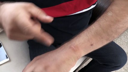 SURİYE'DE İŞKENCE MAĞDURLARI REJİMİN ZİNDANLARINI ANLATIYOR - 'Yaralarımın üzerine ispirto döküp ateşe veriyorlardı' - HATAY