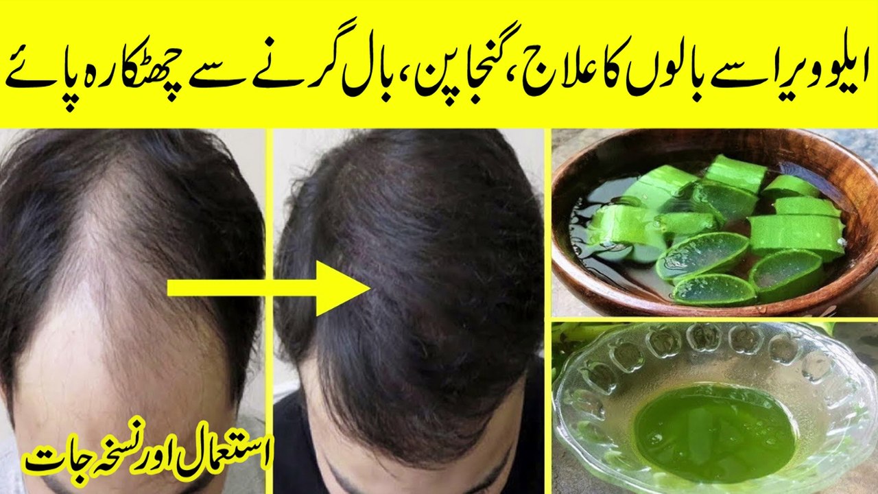 Aloe Vera Hair Growth Oil for Thick Hair || بال گرنا بند گارنٹی کےساتھ