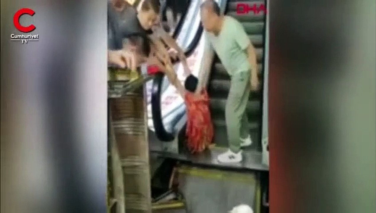 Avm'de feci olay! Arızalı merdiveni kullandı sol bacağı koptu