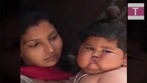 True Story | Giant 8-Month-Old Baby Weighs 38lbs