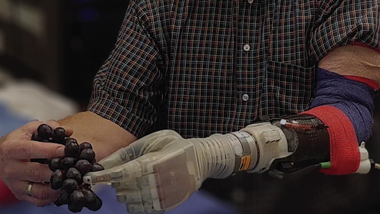 A New Robotic Arm Lets Amputees Feel Again