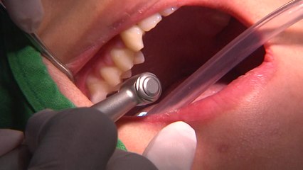 [단독] 앗! 우리 아이 치아가...원인도 모르는 '어금니·앞니 이상' 늘어 / YTN