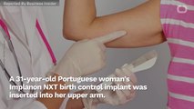 Birth Control Implant Dislodged From Woman's Arm, Migrates To Lung