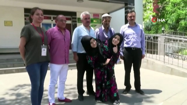 Siyam İkizleri Tercih Yapamadı