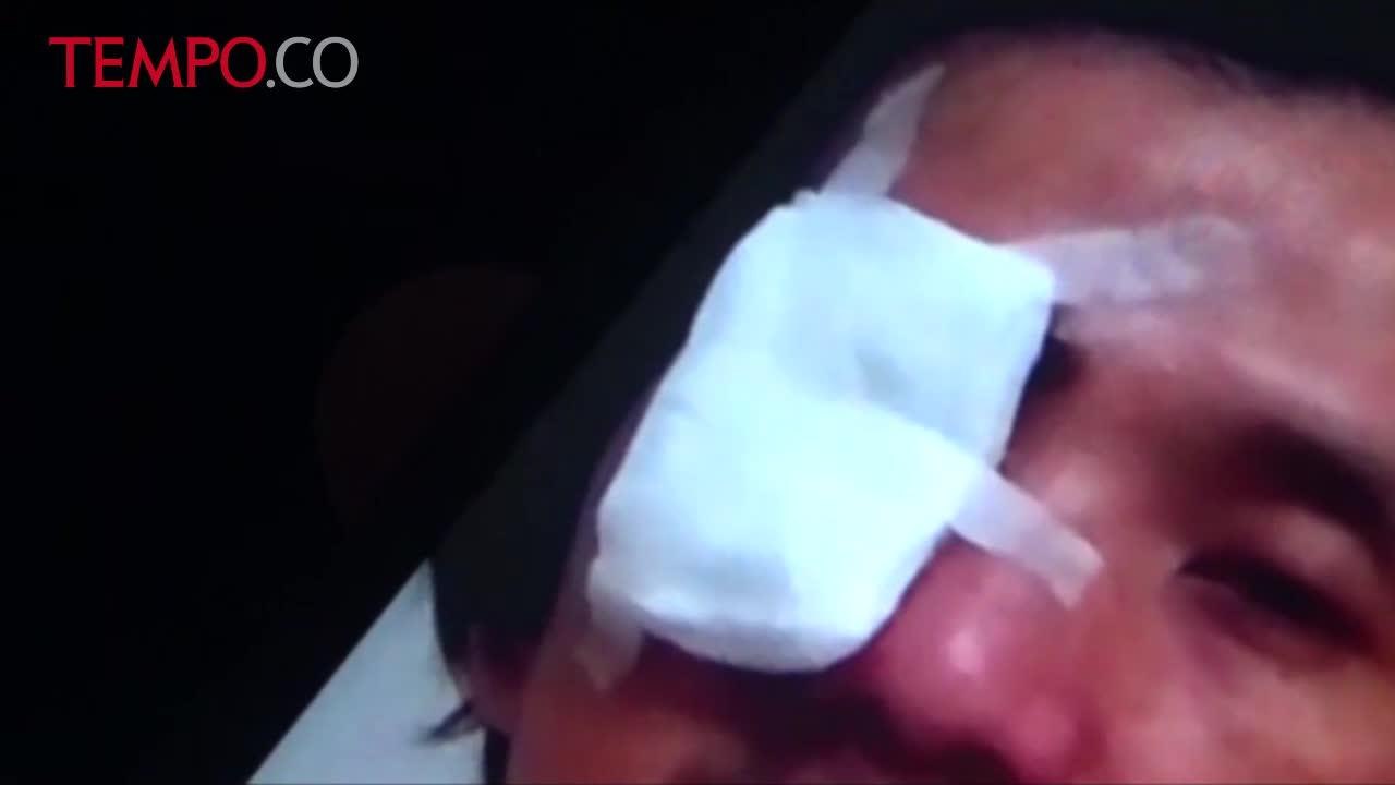 Mirip Kasus Novel, Usai Ibadah Malam, Mata Pria Ini Disiram Air Keras