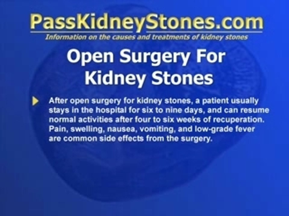 Kidney Stones Open Surgery