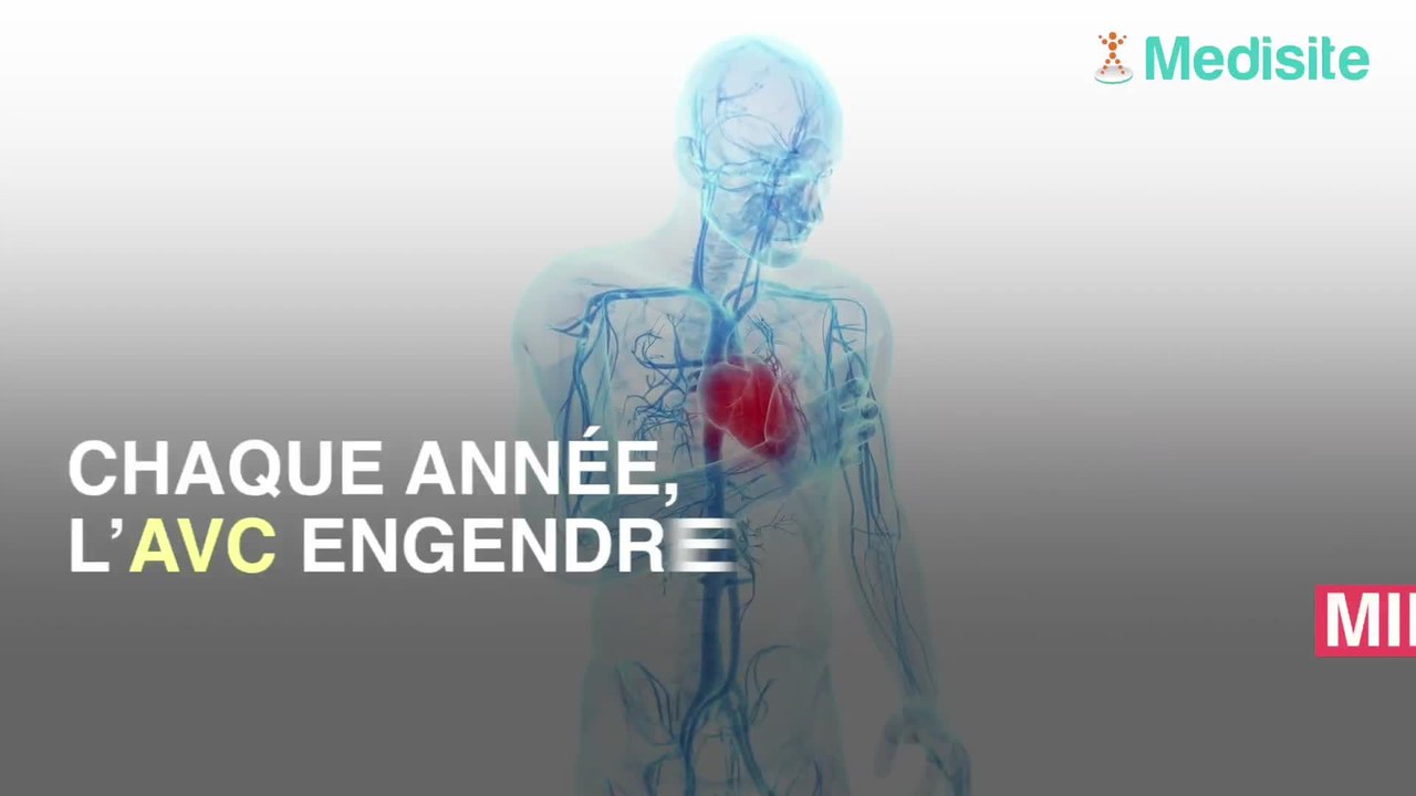 AVC : ces habitudes réduisent vos risques de 90%