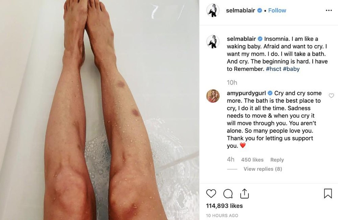 Selma Blair: Kampf mit Schlafstörungen