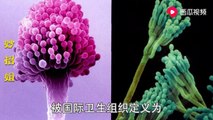 【Cleaning chopsticks】筷子发霉不要扔，只要这样处理一下，就可以和新的一样干净