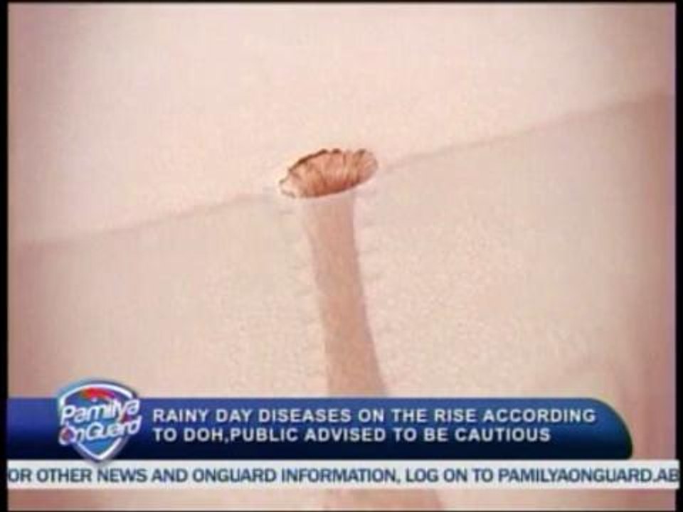pamilyaonguard-MORE THAN 10,000 KINDS OF BACTERIA FOUND ON THE SKIN - EXPERTS