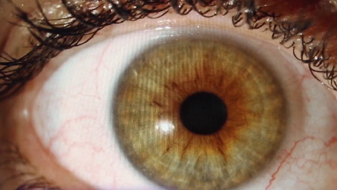 Santé - Soleil, attention les yeux !